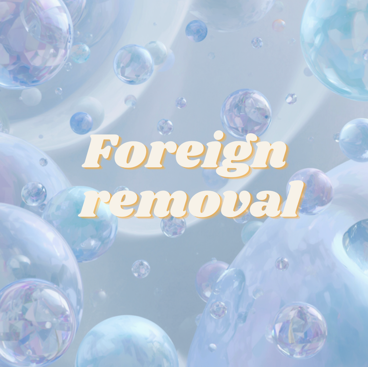 Foreign Removal